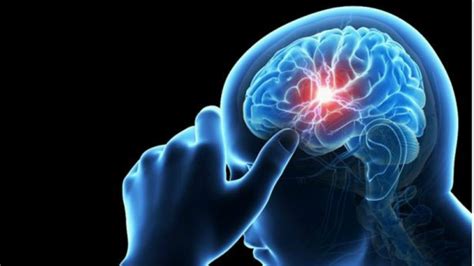 Accidente cerebrovascular y qué hacer ante sus síntomas