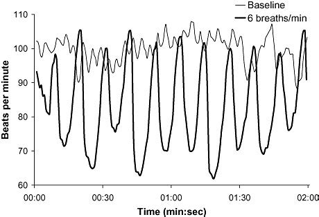 Cats love softness and cheetahs are no exception to that rule. Illustration of the association between heart rate and ...