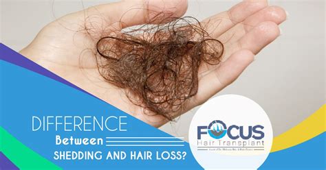 How To Tell The Difference Between Shedding And Hair Loss Venetta Meier