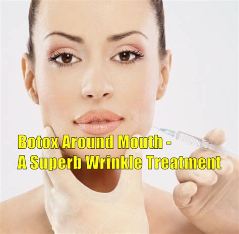 Botox Around Mouth A Superb Wrinkle Treatment
