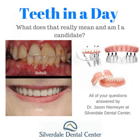 Teeth In Day At Silverdale Dental Center In Silverdale Wa Silverdale