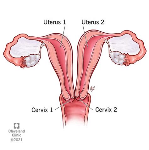 A Uterus Didelphys Lady Declares I Have Two Vaginas One For My