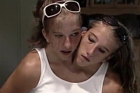 Abby And Brittany Hensel Wedding Pics 2018 - All You Need ...