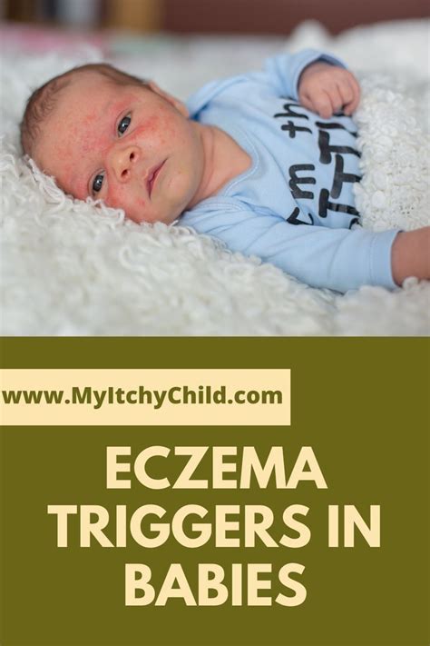 What Triggers Eczema In Toddlers My Itchy Child Baby Eczema