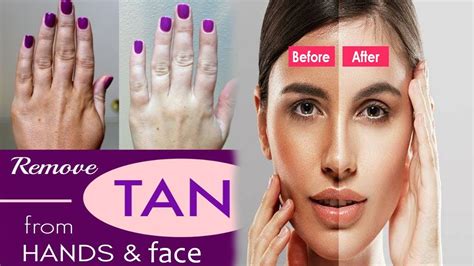 Remove Sun Tan Instantly At Home Face Pack For Tan K Health