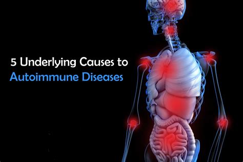 Immune Diseases And Disorders Pictures