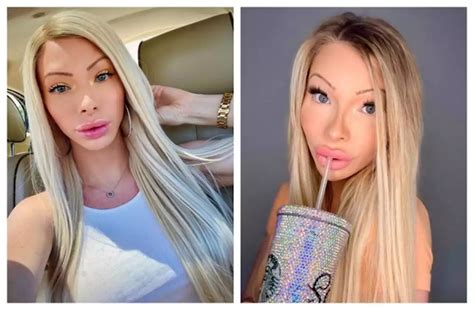 American Woman Who Spent Over Rm200 000 On Plastic Surgery Says It Helps Boost Her Confidence