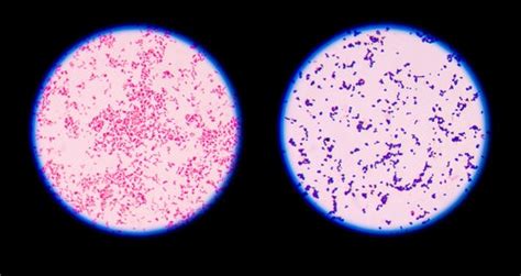 How To Do A Gram Stain Everything You Need To Know Amscope