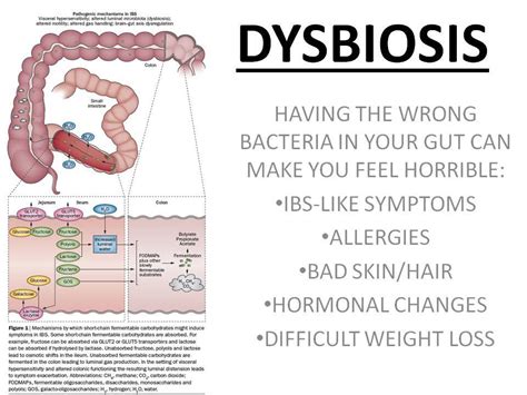 Intestinal Dysbiosis A Common Precursor To Inguinal Hernia Holistic