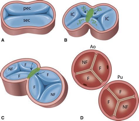 Coding Of Coronary Arterial Origin And Branching In Congenital Heart