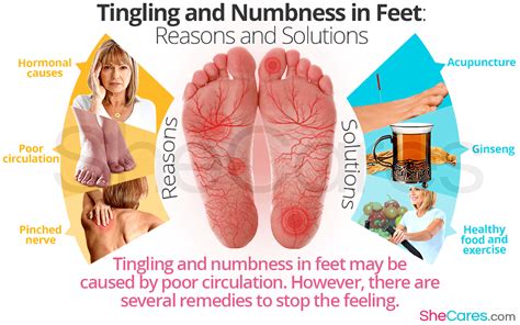 Numbness In Feet Milf Stream