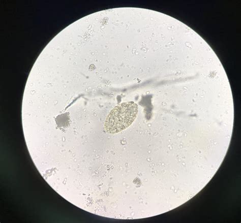 Egg Parasite Human In Stool Examination Stock Image Image Of Ascaris