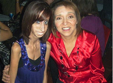 Lizzie Velasquez La Mujer Más Fea Del Mundocn中国最权威