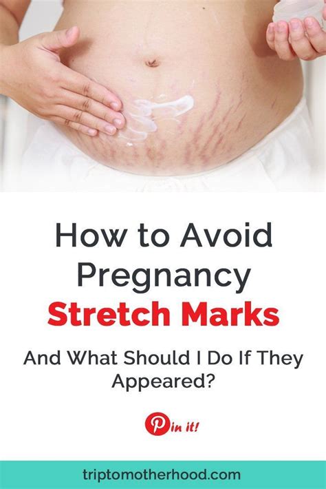 Pin On Preventing Stretch Marks