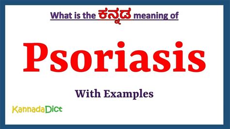 Psoriasis Meaning In Kannada Psoriasis In Kannada Psoriasis In