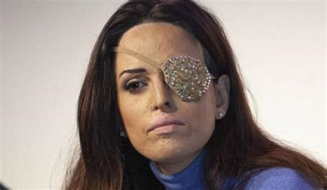 Gessica notaro, la rinascita dopo la drammatica aggressione. Sfregiò con l'acido Gessica Notaro, condannato ...
