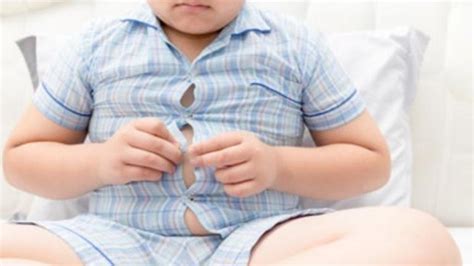 Realidades De La Obesidad Infantil Un Niño “gordito” No Es Un Niño
