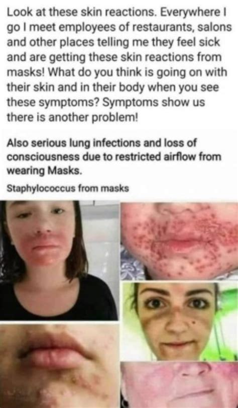 Is Maskne A Sign Of A Lung Infection Truth Or Fiction