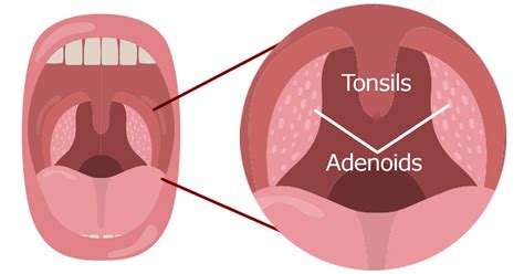 Tonsil Adenoid Anatomy
