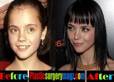 Christina Ricci Plastic Surgery Before And After Plastic Surgery Magazine