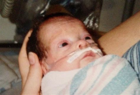 Baby Rachel Was Never Expected To Live But Her Parents Refused