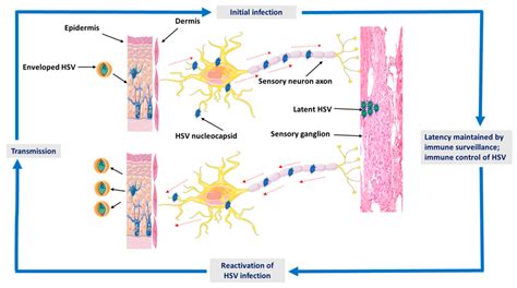 A Graphical Illustration Shows The Epidemiology And Pathogenesis Of