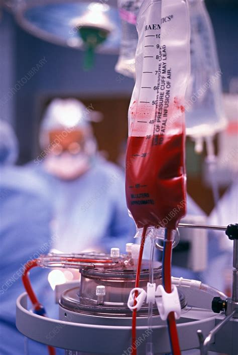 Blood Transfusion Stock Image M5800298 Science Photo Library