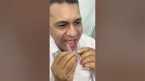 Transforming Smiles, One Aligner at a Time#viral #shortsfeed #