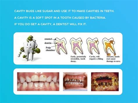 Dental Health Presentation For Kids