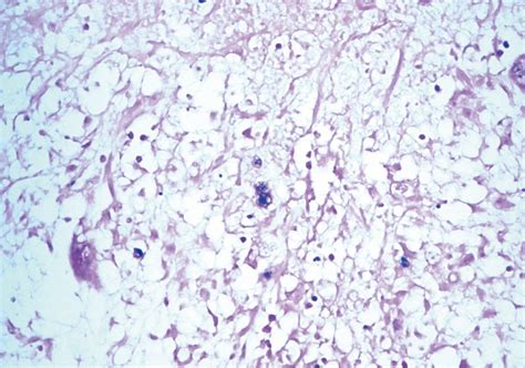 Crystal Violet Staining Demonstrates Multiple Small Bluish Dots In The