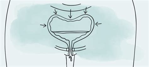 inkontinenz formen ursachen and therapien im Überblick