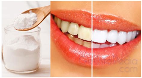 However, learn how to brush and floss your teeth properly to get rid of yellow stains on your teeth. Home Remedies To Get Rid Of Teeth Stains | How to get ...