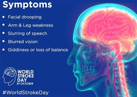 What Is Stroke Symptoms And Prevention Health Vision