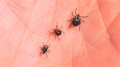 Cdc Warns About Red Meat Allergy Caused By Some Tick Bites Opb