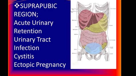 Acute Abdomen Youtube