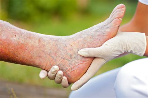 Aging Feet Archives Almawi Limited The Holistic Clinic