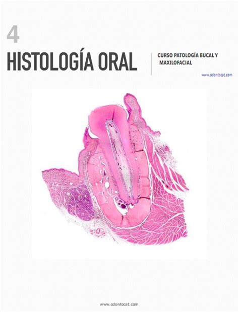 Odontocat Curso Online De Patología Bucal Y Maxilofacial