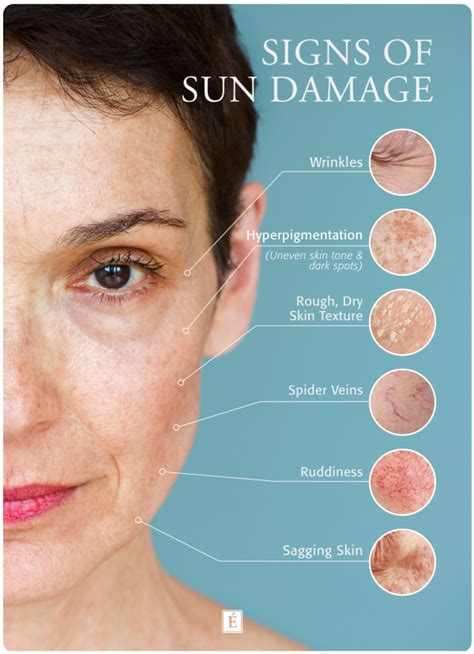 What Does Sun Damaged Skin Look Like Skin Care Sagging Skin Sun