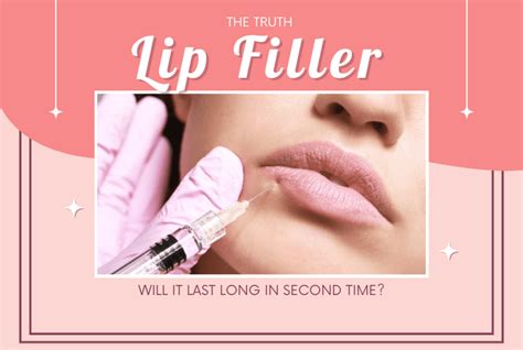 Do Lip Fillers Last Longer The Second Time Or Not Facts