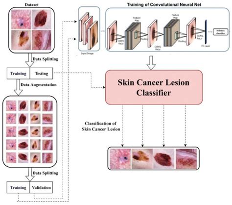 diagnostics free full text an efficient deep learning based skin cancer classifier for an