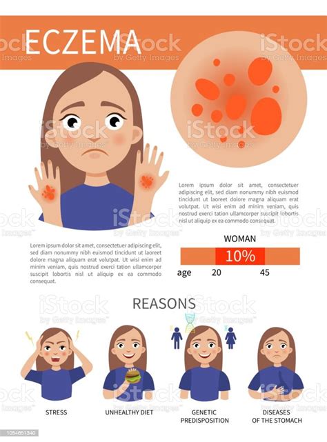 Infographics Of Eczema Stock Illustration Download Image Now