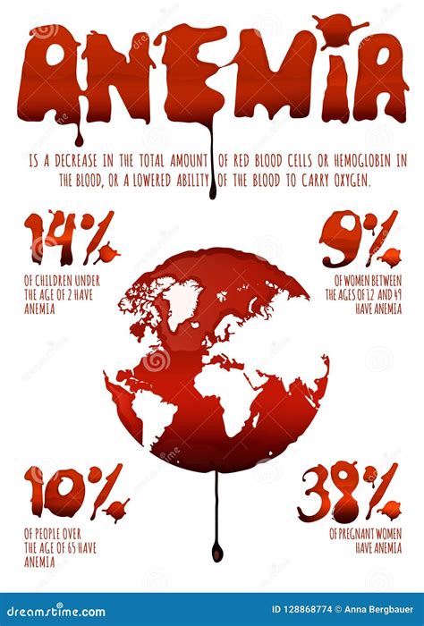 Anemia Infographic Poster Stock Vector Illustration Of Leukemia