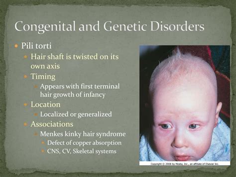 Ppt Disorders Of Pigmentation Powerpoint Presentation Free Download