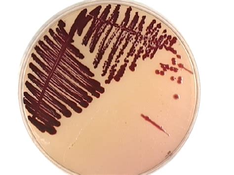 Serratia Marcescens Properties Pathogenesis Diagnosis Microbe Online