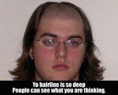 A receding hairline does not simply involve having less hair. The 25+ best Hairline jokes ideas on Pinterest | Funny hairlines, The hist and Thank you soldiers