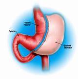 Gastric Intestinal Doctor Images
