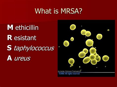Ppt Superbugs And Sepsis Powerpoint Presentation Free Download Id