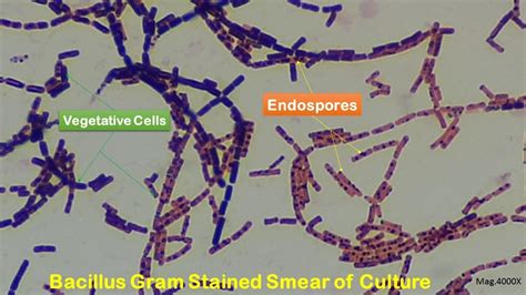 Bacillus Endospores Microscopy Bacillus Colony Morphology And Gram