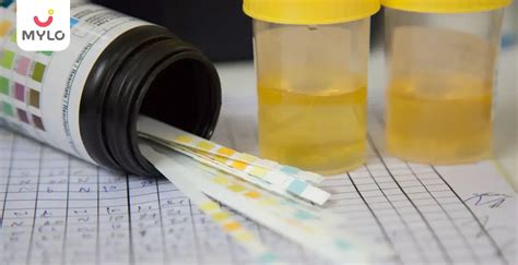 Leukocytes In Urine During Pregnancy Causes Symptoms And Treatment