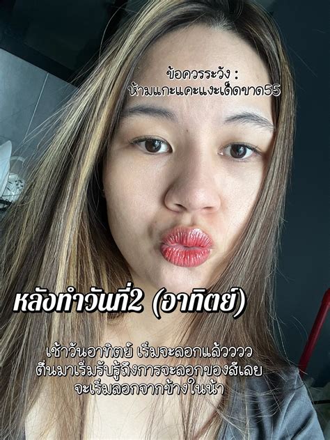 😍ฮาโหลลลมามาอัปเดตหลังสักปากฮะ | แกลเลอรีที่โพสต์โดย หมีมาแชร์ | Lemon8